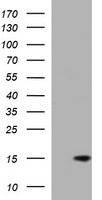 MSMB / MSP Antibody - HEK293T cells were transfected with the pCMV6-ENTRY control (Left lane) or pCMV6-ENTRY MSMB (Right lane) cDNA for 48 hrs and lysed. Equivalent amounts of cell lysates (5 ug per lane) were separated by SDS-PAGE and immunoblotted with anti-MSMB.