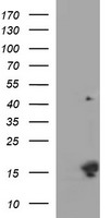 MSMB / MSP Antibody - HEK293T cells were transfected with the pCMV6-ENTRY control (Left lane) or pCMV6-ENTRY MSMB (Right lane) cDNA for 48 hrs and lysed. Equivalent amounts of cell lysates (5 ug per lane) were separated by SDS-PAGE and immunoblotted with anti-MSMB.