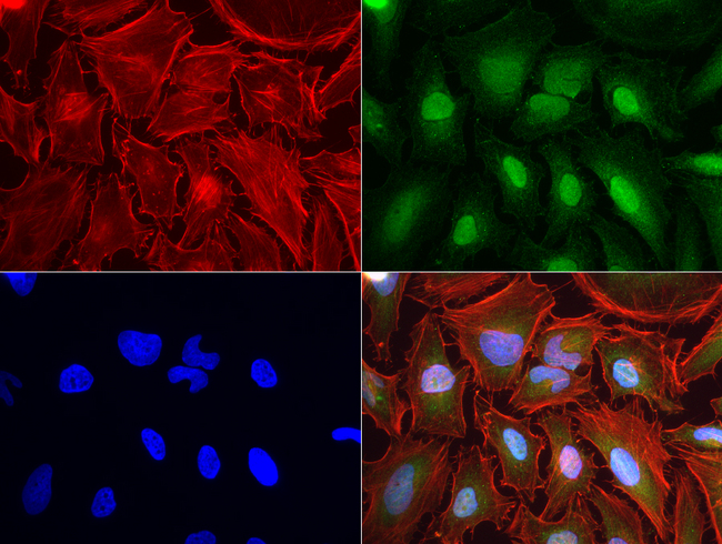 MSMB / MSP Antibody - Immunofluorescent staining of HeLa cells using anti-MSMB mouse monoclonal antibody  green, 1:50). Actin filaments were labeled with Alexa Fluor® 594 Phalloidin. (red), and nuclear with DAPI. (blue).