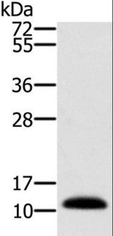 MSMB / MSP Antibody - Western blot analysis of Human prostate tissue, using MSMB Polyclonal Antibody at dilution of 1:250.