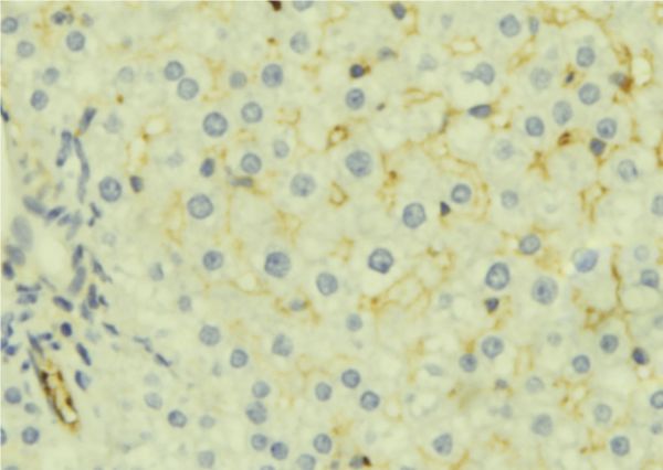 MSMB / MSP Antibody - 1:100 staining mouse liver tissue by IHC-P. The sample was formaldehyde fixed and a heat mediated antigen retrieval step in citrate buffer was performed. The sample was then blocked and incubated with the antibody for 1.5 hours at 22°C. An HRP conjugated goat anti-rabbit antibody was used as the secondary.