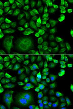 MSMB / MSP Antibody - Immunofluorescence analysis of HeLa cells using MSMB Polyclonal Antibody.