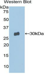 MSN / Moesin Antibody - Western blot of recombinant MSN / Moesin.  This image was taken for the unconjugated form of this product. Other forms have not been tested.
