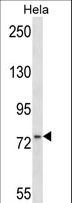 MSN / Moesin Antibody - MSN Antibody western blot of HeLa cell line lysates (35 ug/lane). The MSN antibody detected the MSN protein (arrow).