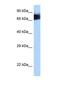 MSN / Moesin Antibody - MSN / Moesin antibody Western blot of HepG2 Cell lysate. Antibody concentration 1 ug/ml.  This image was taken for the unconjugated form of this product. Other forms have not been tested.