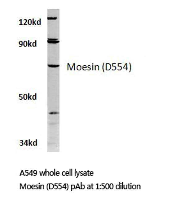 MSN / Moesin Antibody - Western blot of Moesin (D554) pAb in extracts from A549 cells.