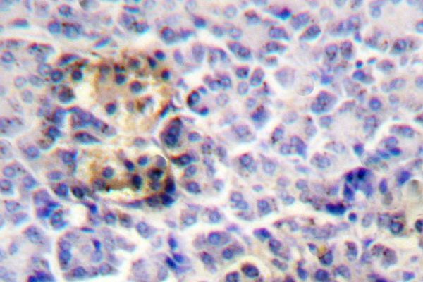 MSN / Moesin Antibody - IHC of Moesin (D554) pAb in paraffin-embedded human pancreas tissue.