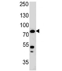 MSN / Moesin Antibody - Western blot testing of human HT29 cell lysate with Moesin antibody (clone MSN/491). Predicted molecular weight ~68 kDa but routinely observed at 68-78 kDa.