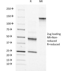 MSN / Moesin Antibody - SDS-PAGE Analysis of Purified, BSA-Free Moesin Antibody (clone MSN/491). Confirmation of Integrity and Purity of the Antibody.