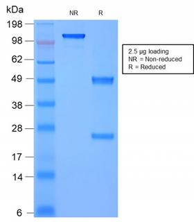 MSN / Moesin Antibody - SDS-PAGE Analysis Purified Moesin Mouse Recombinant Monoclonal Antibody (rMSN/492). Confirmation of Purity and Integrity of Antibody.