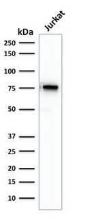 MSN / Moesin Antibody - Western Blot Analysis of human Jurkat Cell lysate using Moesin Mouse Recombinant Monoclonal Antibody (rMSN/492).
