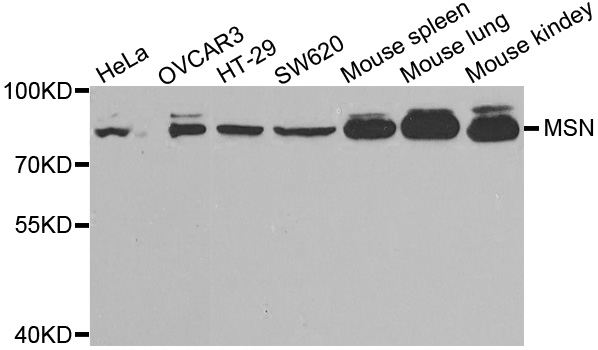 MSN / Moesin Antibody - Western blot analysis of extracts of various cell lines.