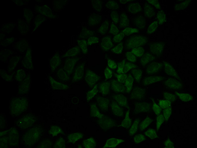MSN / Moesin Antibody - Immunofluorescence analysis of HeLa cells.