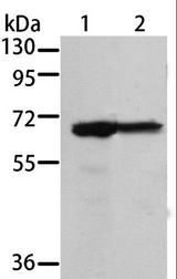 MSN / Moesin Antibody - Western blot analysis of 293T and A431 cell, using MSN Polyclonal Antibody at dilution of 1:500.