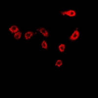 MSN / Moesin Antibody - Immunofluorescent analysis of Moesin staining in HeLa cells. Formalin-fixed cells were permeabilized with 0.1% Triton X-100 in TBS for 5-10 minutes and blocked with 3% BSA-PBS for 30 minutes at room temperature. Cells were probed with the primary antibody in 3% BSA-PBS and incubated overnight at 4 deg C in a humidified chamber. Cells were washed with PBST and incubated with a DyLight 594-conjugated secondary antibody (red) in PBS at room temperature in the dark.