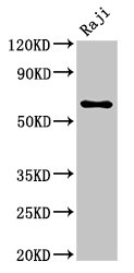 MSN / Moesin Antibody - Positive Western Blot detected in Raji whole cell lysate. All lanes: MSN antibody at 5.7 µg/ml Secondary Goat polyclonal to rabbit IgG at 1/50000 dilution. Predicted band size: 68 KDa. Observed band size: 68 KDa