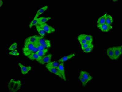 MSN / Moesin Antibody - Immunofluorescence staining of HepG2 cells with MSN Antibody at 1:66, counter-stained with DAPI. The cells were fixed in 4% formaldehyde, permeabilized using 0.2% Triton X-100 and blocked in 10% normal Goat Serum. The cells were then incubated with the antibody overnight at 4°C. The secondary antibody was Alexa Fluor 488-congugated AffiniPure Goat Anti-Rabbit IgG(H+L).