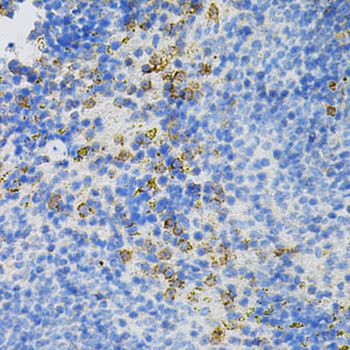 MSN / Moesin Antibody - Immunohistochemistry of paraffin-embedded mouse spleen using MSN antibody at dilution of 1:100 (40x lens).