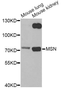 MSN / Moesin Antibody - Western blot analysis of extracts of various cell lines, using MSN antibody at 1:1000 dilution. The secondary antibody used was an HRP Goat Anti-Rabbit IgG (H+L) at 1:10000 dilution. Lysates were loaded 25ug per lane and 3% nonfat dry milk in TBST was used for blocking.