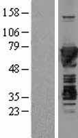 MSN / Moesin Protein - Western validation with an anti-DDK antibody * L: Control HEK293 lysate R: Over-expression lysate