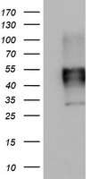 MSR1 / CD204 Antibody - HEK293T cells were transfected with the pCMV6-ENTRY control (Left lane) or pCMV6-ENTRY MSR1 (Right lane) cDNA for 48 hrs and lysed. Equivalent amounts of cell lysates (5 ug per lane) were separated by SDS-PAGE and immunoblotted with anti-MSR1.