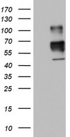 MSR1 / CD204 Antibody - HEK293T cells were transfected with the pCMV6-ENTRY control (Left lane) or pCMV6-ENTRY MSR1 (Right lane) cDNA for 48 hrs and lysed. Equivalent amounts of cell lysates (5 ug per lane) were separated by SDS-PAGE and immunoblotted with anti-MSR1.