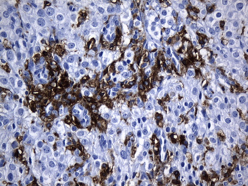 MSR1 / CD204 Antibody - Immunohistochemical staining of paraffin-embedded Human Ovary tissue within the normal limits using anti-MSR1 mouse monoclonal antibody. (Heat-induced epitope retrieval by 1mM EDTA in 10mM Tris buffer. (pH8.5) at 120°C for 3 min. (1:1200)