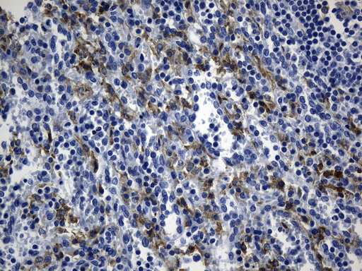 MSR1 / CD204 Antibody - Immunohistochemical staining of paraffin-embedded Human spleen tissue within the normal limits using anti-MSR1 mouse monoclonal antibody. (Heat-induced epitope retrieval by 1mM EDTA in 10mM Tris buffer. (pH8.5) at 120°C for 3 min ). (1:1200)