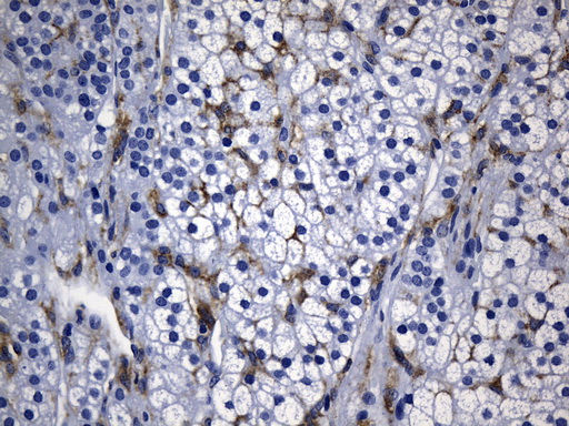 MSR1 / CD204 Antibody - Immunohistochemical staining of paraffin-embedded Human paranephros tissue within the normal limits using anti-MSR1 mouse monoclonal antibody. (Heat-induced epitope retrieval by 1mM EDTA in 10mM Tris buffer. (pH8.5) at 120°C for 3 min. (1:1200)