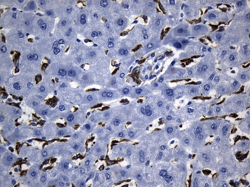 MSR1 / CD204 Antibody - Immunohistochemical staining of paraffin-embedded Human liver tissue within the normal limits using anti-MSR1 mouse monoclonal antibody. (Heat-induced epitope retrieval by 1mM EDTA in 10mM Tris buffer. (pH8.5) at 120°C for 3 min. (1:1200)