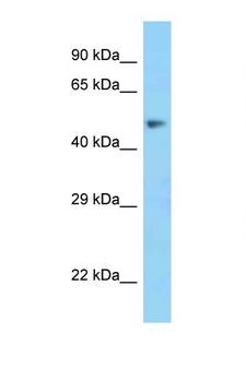 MSR1 / CD204 Antibody - MSR1 / CD204 antibody Western blot of Fetal Liver lysate. Antibody concentration 1 ug/ml.  This image was taken for the unconjugated form of this product. Other forms have not been tested.