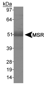 MSR1 / CD204 Antibody - Detection of MSR in human liver.  This image was taken for the unconjugated form of this product. Other forms have not been tested.