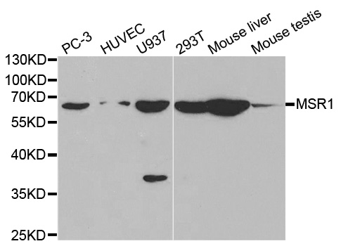 MSR1 / CD204 Antibody - Western blot analysis of extracts of various cell lines, using MSR1 antibody.