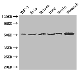 MSR1 / CD204 Antibody - Positive WB detected in:THP-1 whole cell lysate,Hela whole cell lysate,Mouse spleen tissue,Mouse lung tissue,Mouse brain tissue,Mouse stomach tissue;All lanes: MSR1 antibody at 1.5ug/ml;Secondary;Goat polyclonal to rabbit IgG at 1/50000 dilution;Predicted band size: 50,40,43 kDa;Observed band size: 50 kDa;
