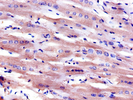 MSR1 / CD204 Antibody - Immunohistochemistry of paraffin-embedded human heart tissue using MSR1 Antibody at dilution of 1:100