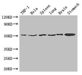 MSR1 / CD204 Antibody - Western Blot Positive WB detected in: THP-1 whole cell lysate, Hela whole cell lysate, Mouse spleen tissue, Mouse lung tissue, Mouse brain tissue, Mouse stomach tissue All lanes: MSR1 antibody at 1.5µg/ml Secondary Goat polyclonal to rabbit IgG at 1/50000 dilution Predicted band size: 50, 40, 43 kDa Observed band size: 50 kDa
