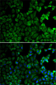 MSR1 / CD204 Antibody - Immunofluorescence analysis of HeLa cells using MSR1 antibody. Blue: DAPI for nuclear staining.