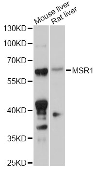 MSR1 / CD204 Antibody - Western blot analysis of extracts of various cell lines, using MSR1 antibody at 1:1000 dilution. The secondary antibody used was an HRP Goat Anti-Rabbit IgG (H+L) at 1:10000 dilution. Lysates were loaded 25ug per lane and 3% nonfat dry milk in TBST was used for blocking. An ECL Kit was used for detection and the exposure time was 90s.