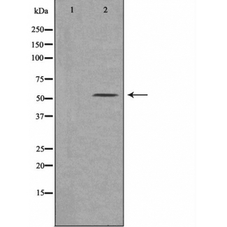 MSR1 / CD204 Antibody - Western blot analysis of extracts of various cells lines using MSR1 antibody.