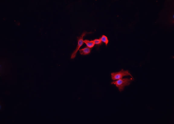 MSR1 / CD204 Antibody - Staining HepG2 cells by IF/ICC. The samples were fixed with PFA and permeabilized in 0.1% Triton X-100, then blocked in 10% serum for 45 min at 25°C. The primary antibody was diluted at 1:200 and incubated with the sample for 1 hour at 37°C. An Alexa Fluor 594 conjugated goat anti-rabbit IgG (H+L) antibody, diluted at 1/600, was used as secondary antibody.