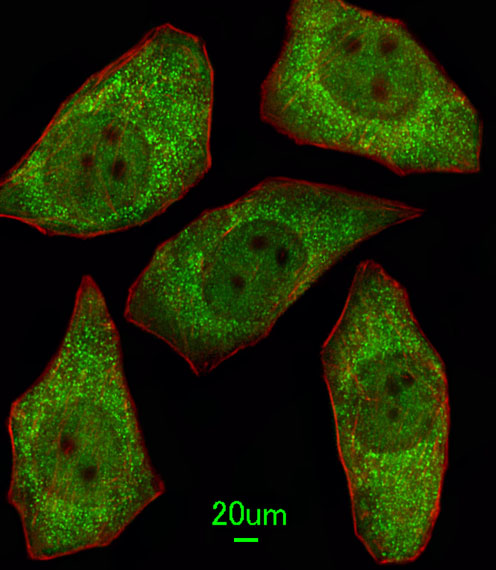 MSRA Antibody - Immunofluorescence of A549 cells, using MSRA Antibody. Antibody was diluted at 1:100 dilution. Alexa Fluor 488-conjugated goat anti-rabbit lgG at 1:400 dilution was used as the secondary antibody (green). Cytoplasmic actin was counterstained with Dylight Fluor 554 (red) conjugated Phalloidin (red).