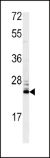 MSRA Antibody - Western blot of MSRA antibody in mouse kidney tissue lysates (35 ug/lane). MSRA (arrow) was detected using the purified antibody.