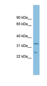 MSRA Antibody - MSRA antibody Western Blot analysis of Fetal Lung lysate. This image was taken for the unconjugated form of this product. Other forms have not been tested.