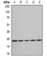 MSRA Antibody - Western blot analysis of MsrA expression in HT29 (A); HeLa (B); mouse heart (C); rat kidney (D); rat liver (E) whole cell lysates.