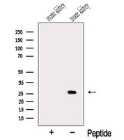 MSRA Antibody - Western blot analysis of extracts of mouse kidney tissue using MSRA antibody. The lane on the left was treated with blocking peptide.