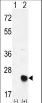 MSRB2 / MSRB Antibody - Western blot of MSRB2 (arrow) using rabbit polyclonal MSRB2 Antibody. 293 cell lysates (2 ug/lane) either nontransfected (Lane 1) or transiently transfected (Lane 2) with the MSRB2 gene.