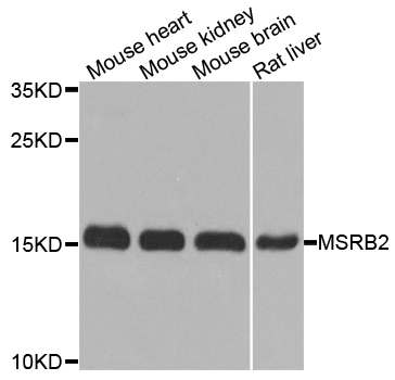 MSRB2 / MSRB Antibody - Western blot analysis of extracts of various cell lines.