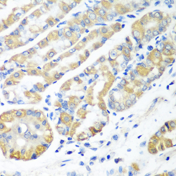MSRB2 / MSRB Antibody - Immunohistochemistry of paraffin-embedded human stomach tissue.