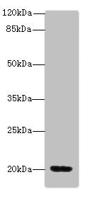 MSRB2 / MSRB Antibody - Western blot All Lanes: MSRB2antibody at 5.58ug/ml+ Mouse heart tissue Goat polyclonal to rabbit at 1/10000 dilution Predicted band size: 20 kDa Observed band size: 20 kDa