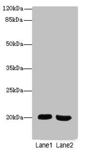 MSRB2 / MSRB Antibody - Western blot All Lanes: MSRB2antibody at 2.66ug/ml Lane 1 : Mouse heart tissue Lane 2 : Mouse brain tissue Secondary Goat polyclonal to Rabbit IgG at 1/10000 dilution Predicted band size: 20 kDa Observed band size: 20 kDa
